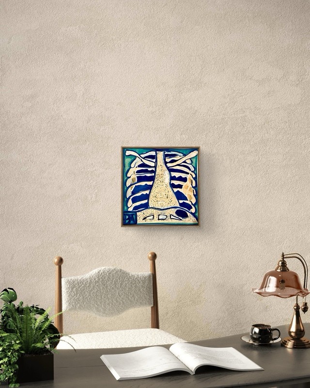 Neurofibromatosis Type 1 NF1 Heart Chest Xray Lungs Medical 30x30cm Canvas Print gallery
