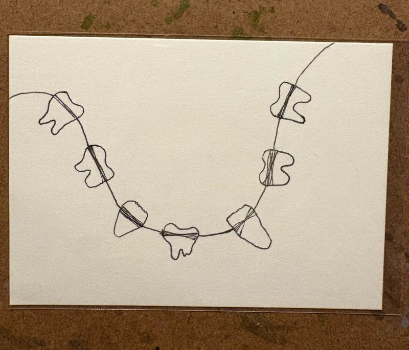 ACEO Original 2.5×3.5 Art Card – Sting of Teeth