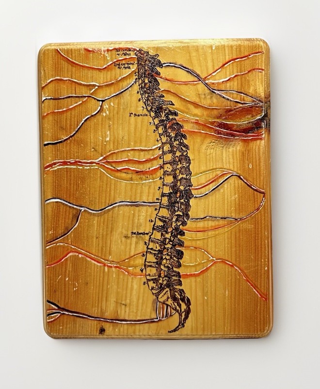 Anatomy Spine Nerves Art On Pine Wood Panel Medical Decor Handcrafted Signed