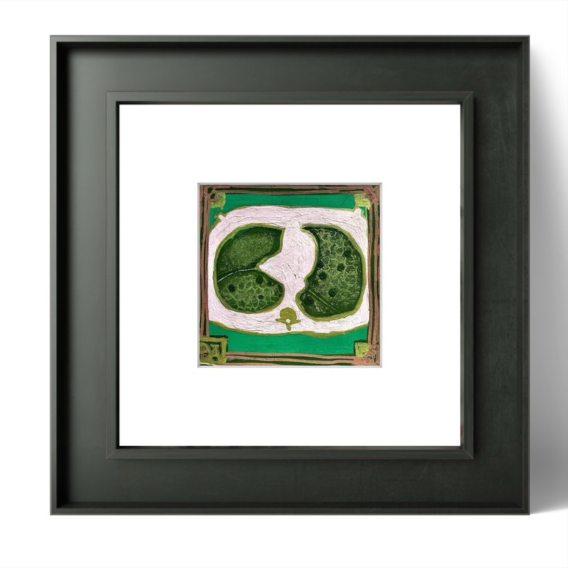 Lymphocytic Interstitial Pneumonia Medical Radiology Art 10cm Original Painting